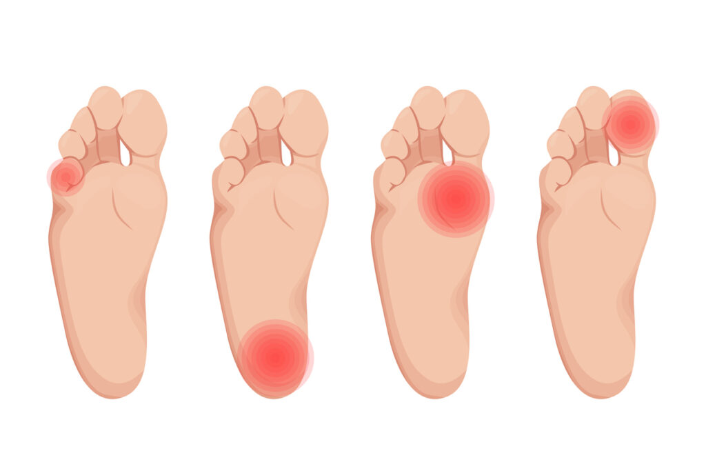 Foot and toes pain vector illustration design. Heel with plantar spurs, toe pathology.